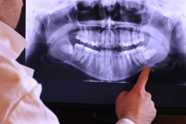 Best Urgent Care for Lost Fillings or Crowns in Marietta, GA